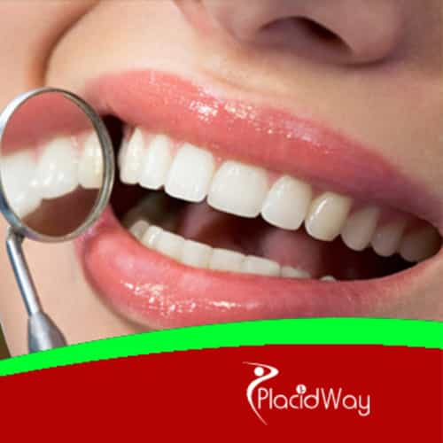 Best Dental Veneers in Liberia, Costa Rica